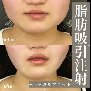 EMMO FACE CLINIC 大阪梅田院 山﨑 冴羅医師の症例