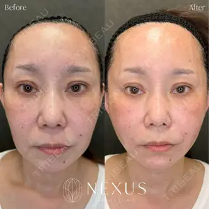 NEXUS CLINIC 酒井　知子医師の症例