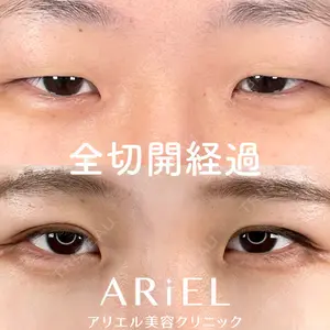 アリエル美容クリニック 大宮院 鈴木　桂介医師の症例