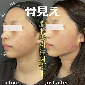 EMMO FACE CLINIC 大阪梅田院 山﨑 冴羅医師の症例