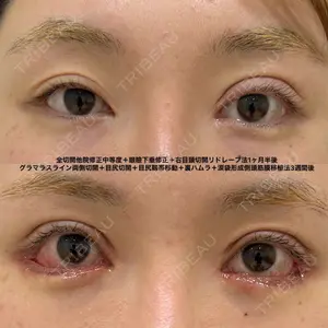 エターナル美容クリニック 久門田 詳医師の症例