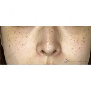 Original Beauty Clinic GINZA 佐藤玲史医師の症例