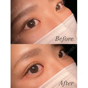 HAAB×DREAM BEAUTY CLINIC 東京本院 佐野 圭医師の症例