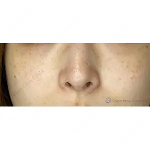 Original Beauty Clinic GINZA 佐藤玲史医師の症例