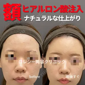 ロレシー美容クリニック 心斎橋駅前院 福留院長医師の症例