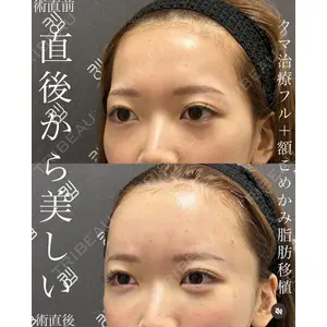 EMMO FACE CLINIC 大宮院 廣松 直樹医師の症例