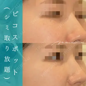 Mavie Beauty Clinic （マヴィービューティークリニック）の症例