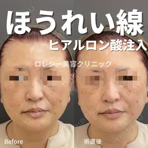 ロレシー美容クリニック 心斎橋駅前院 福留院長医師の症例