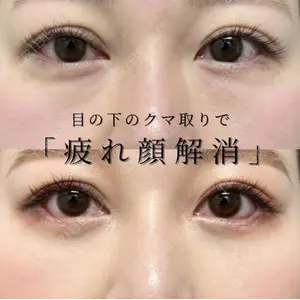 グローバルビューティークリニック 大阪院の症例