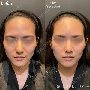 DMTC美容皮膚科 日本橋院 松井泉医師の症例