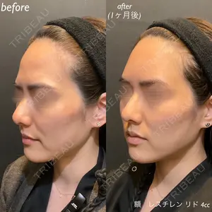 DMTC美容皮膚科 日本橋院 松井泉医師の症例