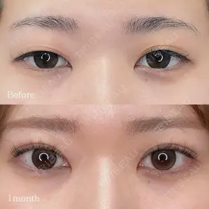 東京シンデレラ美容外科 池袋院の症例