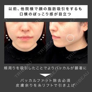 東京シンデレラ美容外科 池袋院の症例