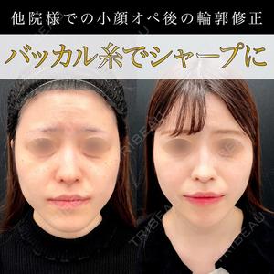 東京シンデレラ美容外科 池袋院の症例