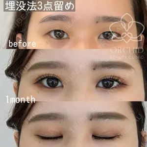 オーキッド美容クリニック東京御徒町 西浦 蘭子医師の症例