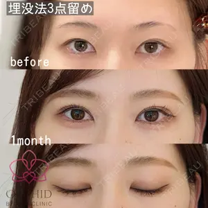 オーキッド美容クリニック東京御徒町 西浦 蘭子医師の症例
