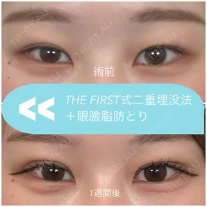 THE FIRST CLINIC 多摩センター院 惟村 公郁医師の症例