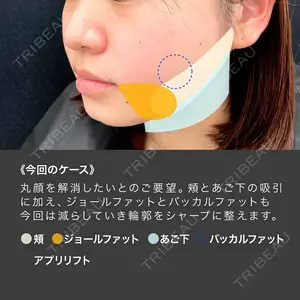 東京シンデレラ美容外科 池袋院の症例