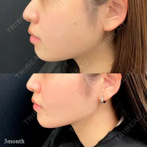 東京シンデレラ美容外科 池袋院の症例