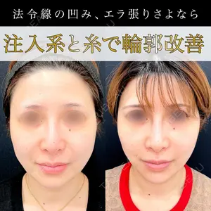 東京シンデレラ美容外科 池袋院の症例