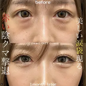 EMMO FACE CLINIC 大阪梅田院 山﨑 冴羅医師の症例