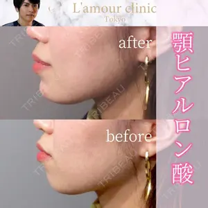 L‘amour clinic Tokyo【ラムールクリニック東京】の症例