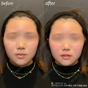 DMTC美容皮膚科 日本橋院 山中大介医師の症例