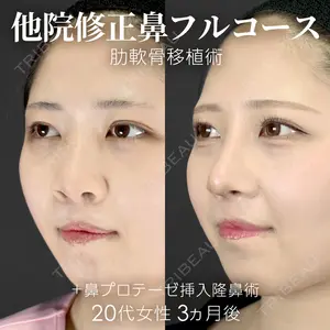 ジョウクリニック 銀座院 重本　譲医師の症例