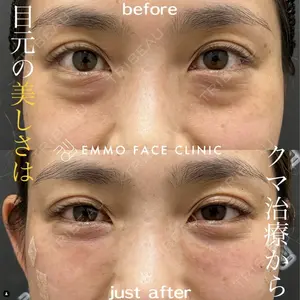 EMMO FACE CLINIC 大阪梅田院 山﨑 冴羅医師の症例