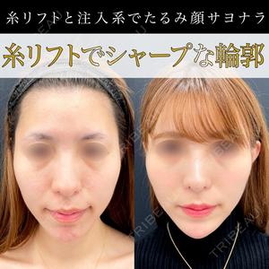 東京シンデレラ美容外科 池袋院の症例