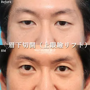 ヴェリテクリニック 大阪院 森島 容子医師の症例