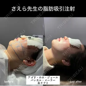 EMMO FACE CLINIC 大阪梅田院 山﨑 冴羅医師の症例