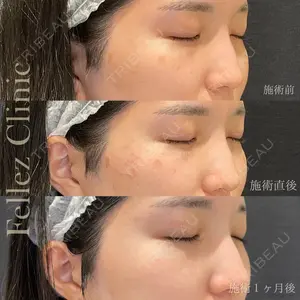 Fellez Clinic【フェルズクリニック】 小野 泰寛医師の症例