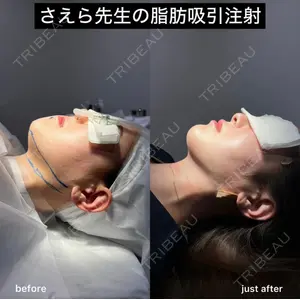 EMMO FACE CLINIC 大阪梅田院 山﨑 冴羅医師の症例