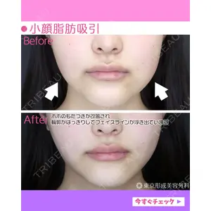 東京形成美容外科 船橋院 山崎 修吾医師の症例