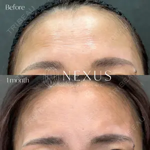 NEXUS CLINIC 渡辺　佳奈医師の症例