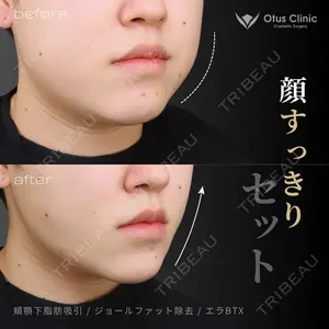 Otus Clinic 【オータスクリニック】 中 徳太郎医師の症例
