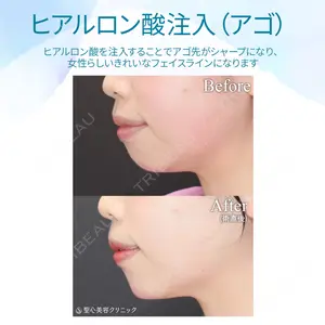 聖心美容クリニック 大阪院 大井 弘一医師の症例