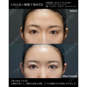 BIANCA銀座 堀田 和亮医師の症例