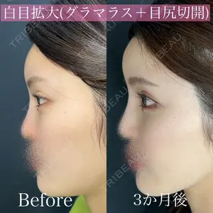 ルラ美容クリニック 渋谷本院 昼間 路子医師の症例