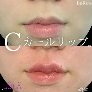 ルラ美容クリニック 新潟院の症例