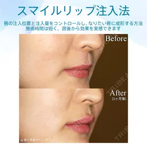 聖心美容クリニック 札幌院 前多 一彦医師の症例