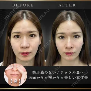 ルラ美容クリニック 池袋院 小海 元｜長期休暇につき指名不可医師の症例