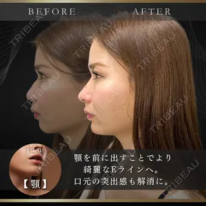 ルラ美容クリニック 池袋院 小海 元｜長期休暇につき指名不可医師の症例