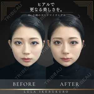 ルラ美容クリニック 池袋院 小海 元｜長期休暇につき指名不可医師の症例