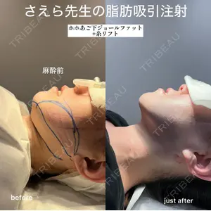 EMMO FACE CLINIC 大阪梅田院 山﨑 冴羅医師の症例