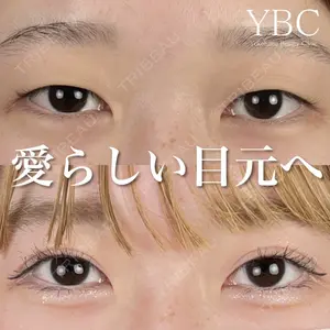 YBC横浜美容外科 大宮院 磯村 亮輔医師の症例