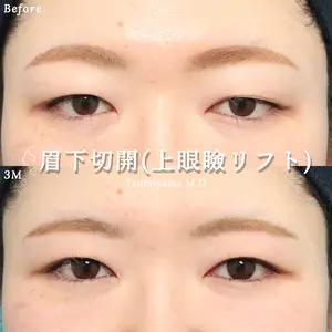 ヴェリテクリニック 銀座院 積山 真也医師の症例