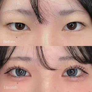 東京シンデレラ美容外科 池袋院の症例