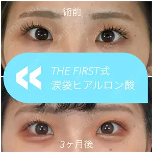 THE FIRST CLINIC 多摩センター院の症例